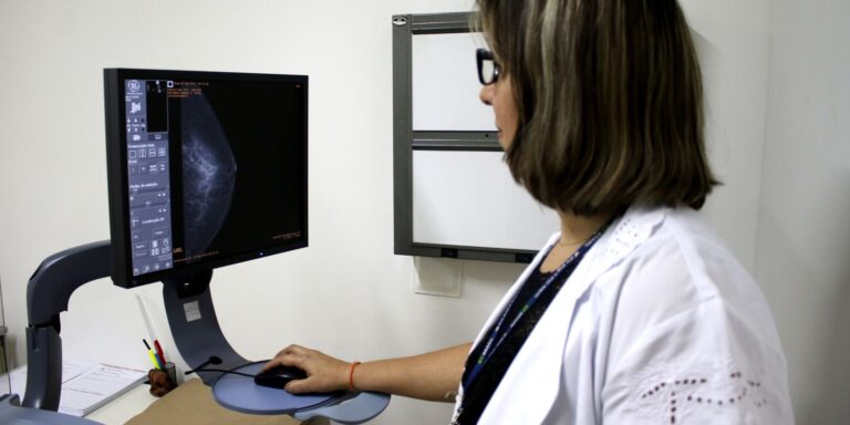 ministerio-da-saude-recomenda-mamografia-no-sus-a-partir-dos-40-anos