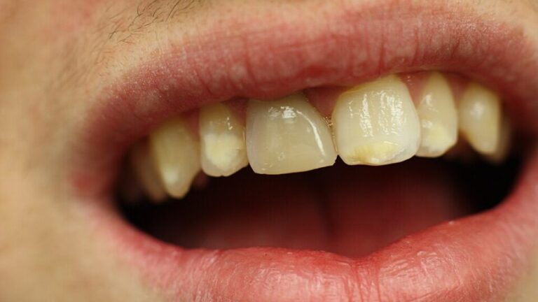 Cientistas descobrem células-tronco capazes de regenerar naturalmente dentes e ossos cientistas-descobrem-celulas-tronco-capazes-de-regenerar-naturalmente-dentes-e-ossos