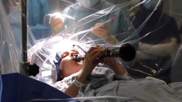 mulher-com-parkinson-toca-clarinete-durante-operacao-ao-cerebro;-veja!