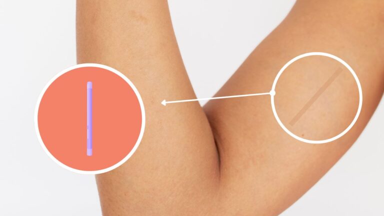 valenca-inicia-oferta-gratuita-do-implanon-na-rede-publica-de-saude