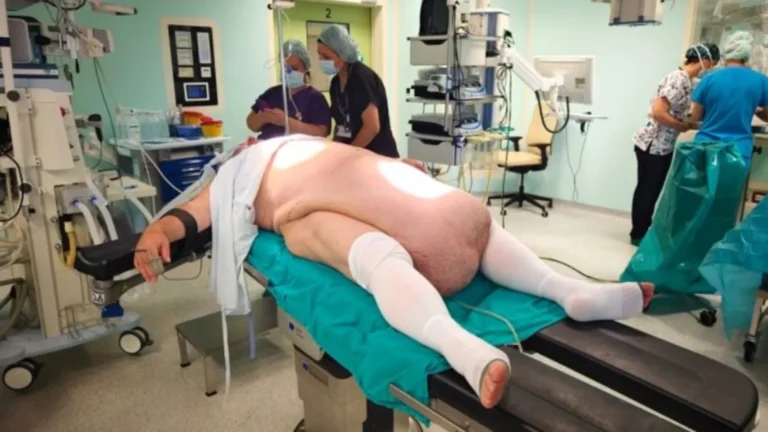 tumor-abdominal-de-35-kg-impede-homem-de-urinar-e-choca-medicos