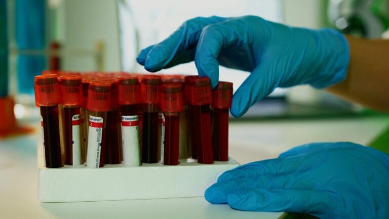 caes-treinados-conseguem-detectar-sinais-de-cancer-em-amostras-de-sangue