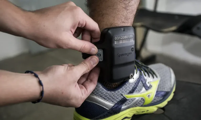 camara-aprova-uso-obrigatorio-de-tornozeleira-por-agressores-de-mulher