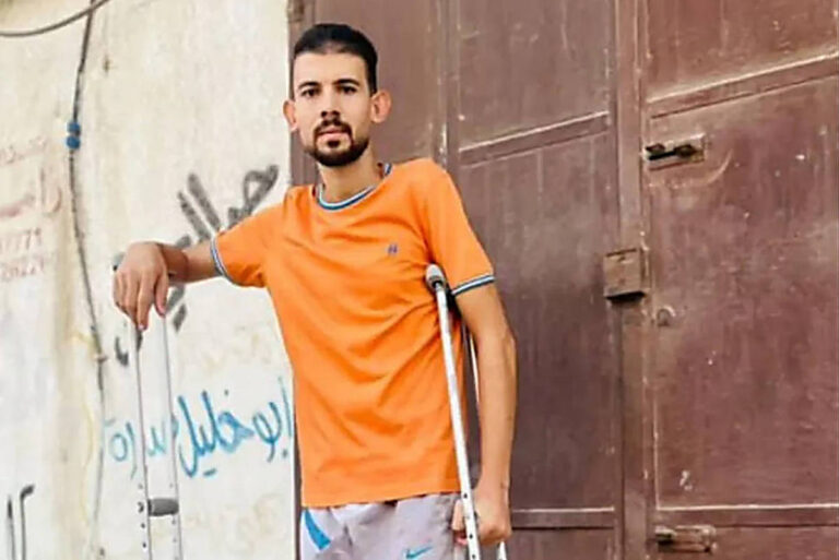 amputados-de-gaza-lidam-com-escassez-de-proteses-por-bloqueio-israelense