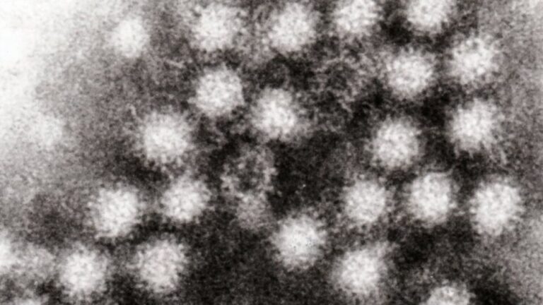 Surto de norovírus atinge mais de 100 pessoas em cruzeiro que partiu da Flórida surto-de-norovirus-atinge-mais-de-100-pessoas-em-cruzeiro-que-partiu-da-florida