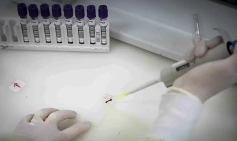 paciente-com-suspeita-de-ebola-em-sp-testa-positivo-para-meningite