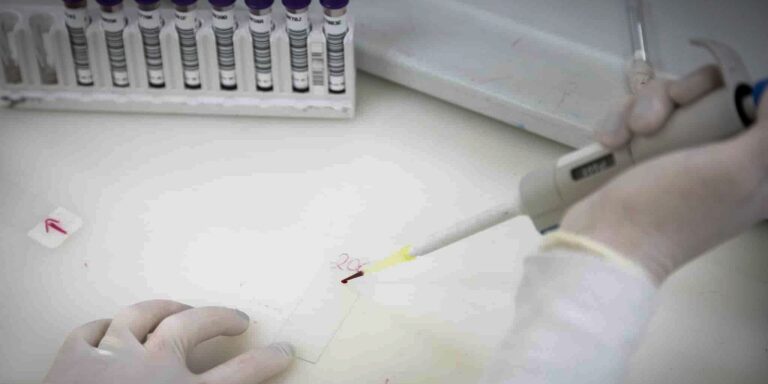 Exames descartam ebola em imigrante da República Democrática do Congo exames-descartam-ebola-em-imigrante-da-republica-democratica-do-congo